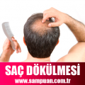 Saç Dökülmesi